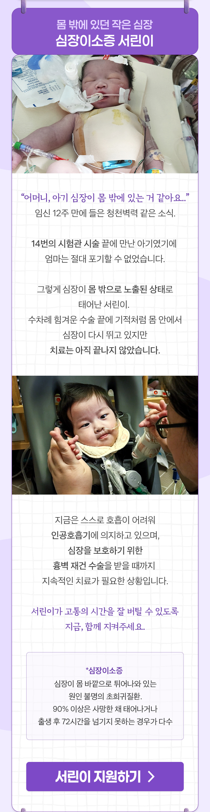 
                몸 밖에 있던 작은 심장
                심장이소증 서린이

                “어머니, 아기 심장이 몸 밖에 있는 거 같아요..”
                임신 12주 만에 들은 청천벽력 같은 소식.

                14번의 시험관 시술 끝에 만난 아기였기에
                엄마는 절대 포기할 수 없었습니다.

                그렇게 심장이 몸 밖으로 노출된 상태로 태어난 서린이.
                수차례 힘겨운 수술 끝에 기적처럼 
                몸 안에서 심장이 다시 뛰고 있지만
                치료는 아직 끝나지 않았습니다.

                지금은 스스로 호흡이 어려워 인공호흡기에 의지하고 있으며,
                심장을 보호하기 위한 흉벽 재건 수술을 받을 때까지 
                지속적인 치료가 필요한 상황입니다.

                서린이가 고통의 시간을 잘 버틸 수 있도록
                지금, 함께 지켜주세요.

                *심장이소증 : 심장이 몸 바깥으로 튀어나와 있는 원인 불명의 초희귀질환 . 
                90% 이상은 사망한 채 태어나거나 출생 후 72시간을 넘기지 못하는 경우가 다수
