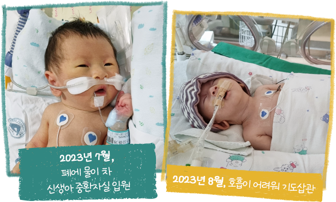 2023. 07폐에 물이 차 신생아 중환자실 입원, 2023. 08호흡이 어려워 기도삽관